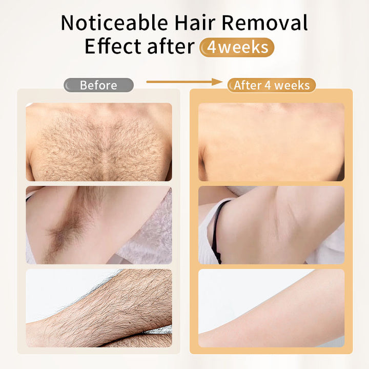 Pro IPL Laser Hair Removal Handset with LCD Display – Dual Heads for Hair Removal + Skin Rejuvenation | 400,000 Flashes | 21J Max Power