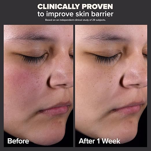 PAULA'S CHOICE Skin Perfecting 2% BHA Liquid Exfoliant - 118ml | Blackhead & Pore Solution