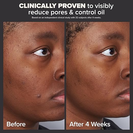 PAULA'S CHOICE Skin Perfecting 2% BHA Liquid Exfoliant - 118ml | Blackhead & Pore Solution