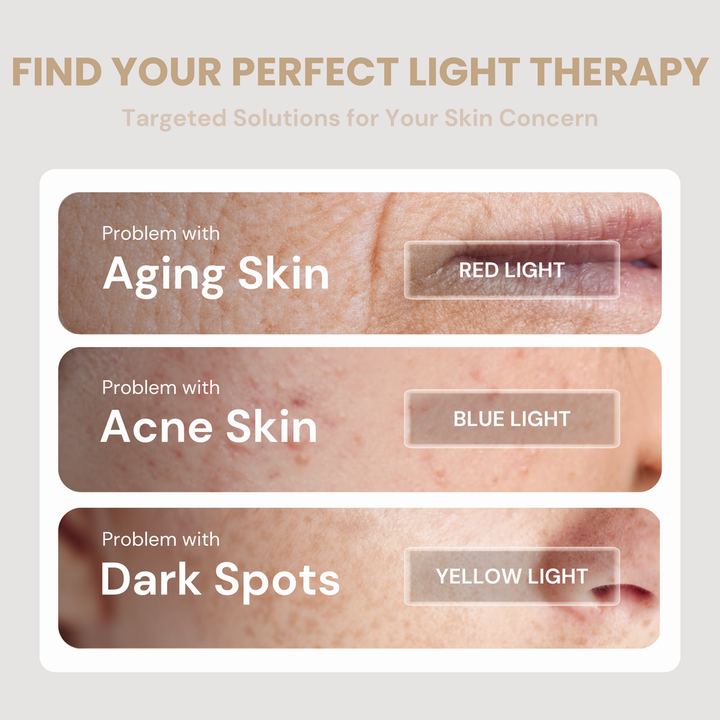 LED Face Mask – 3-Color Light Therapy for Acne, Wrinkles & Glowing Skin | Wireless, Eye-Safe, Fast Results | TOUCHBeauty™ GLAM