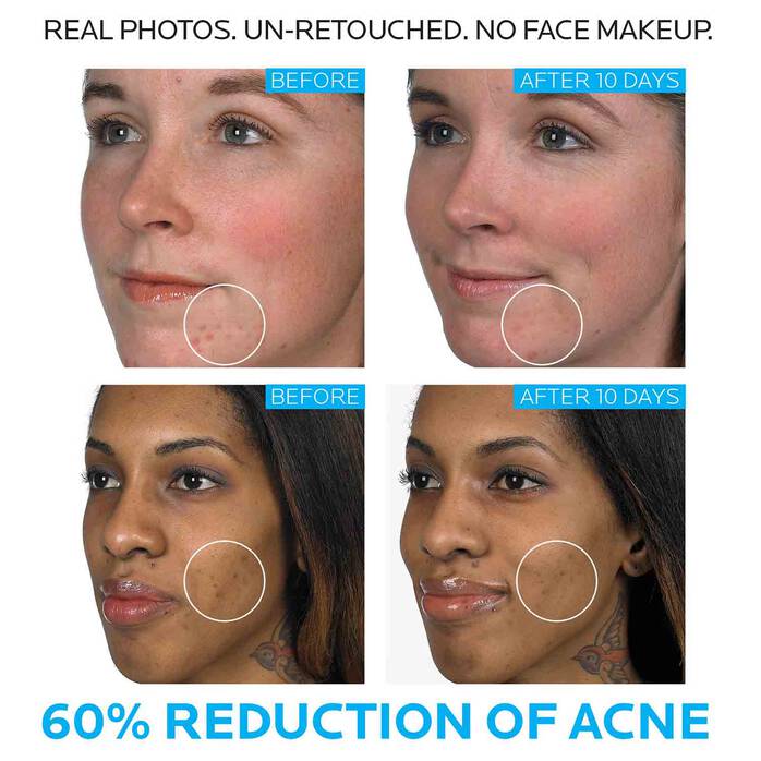 La Roche-Posay Effaclar Duo+ SPF30 with Niacinamide 40ml