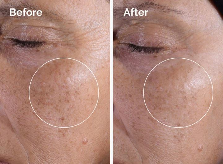 Glycolic Acid 7% Exfoliating Toner