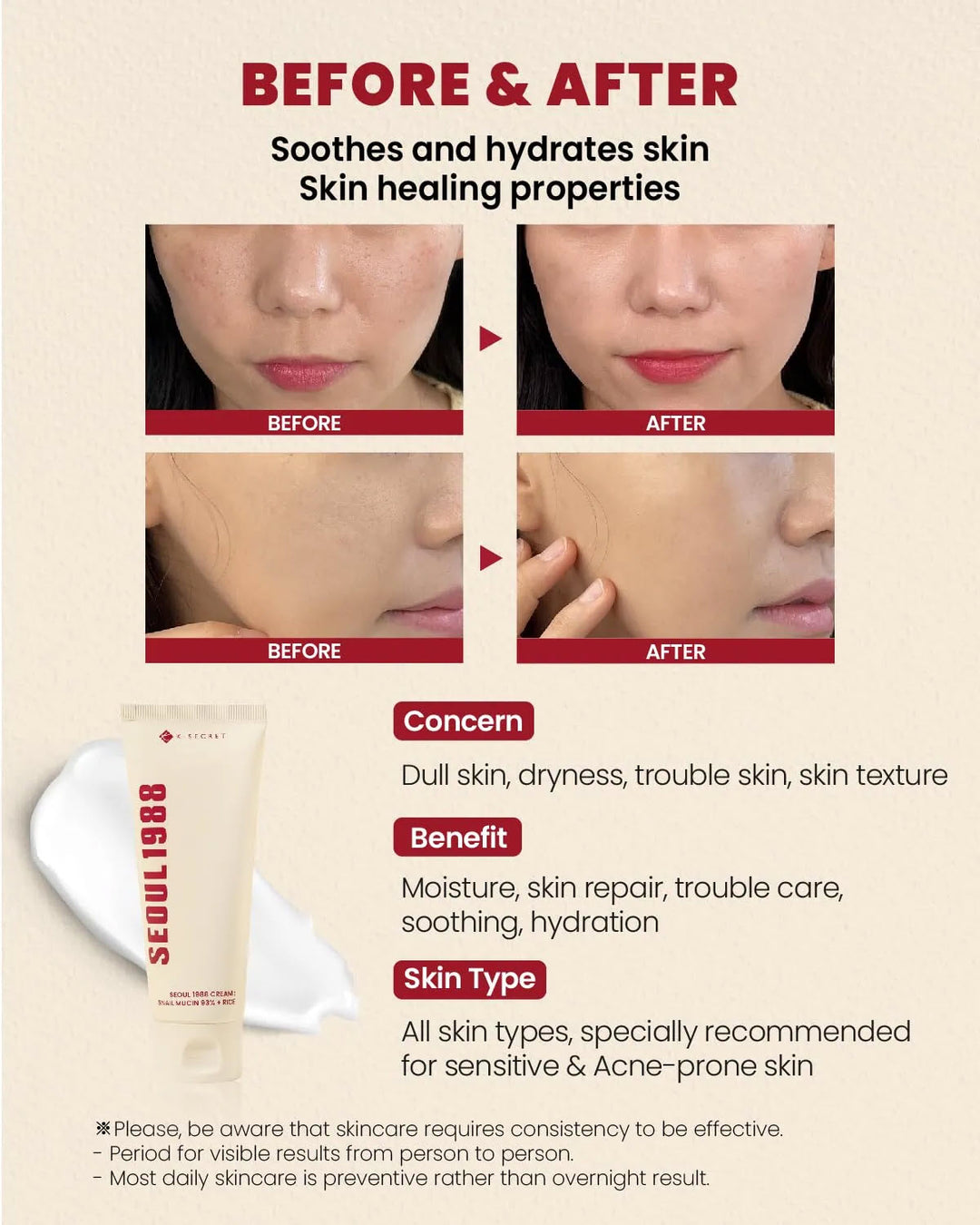 K-SECRET SEOUL 1988 Cream Snail Mucin 93% + Rice