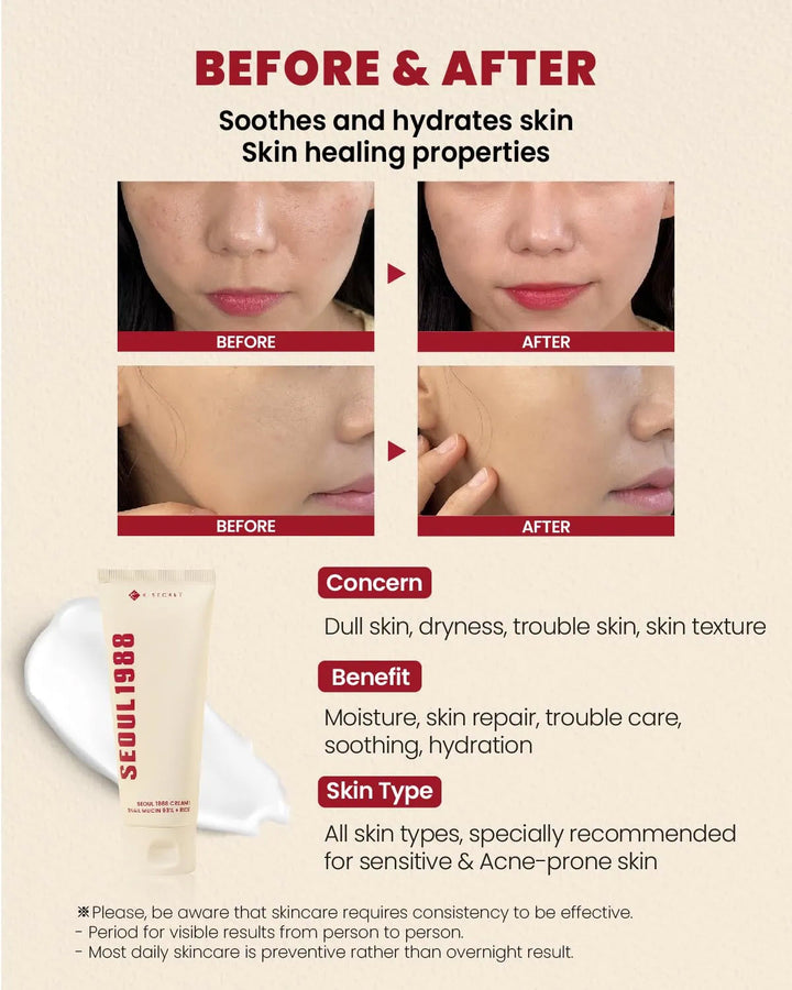 K-SECRET SEOUL 1988 Cream Snail Mucin 93% + Rice