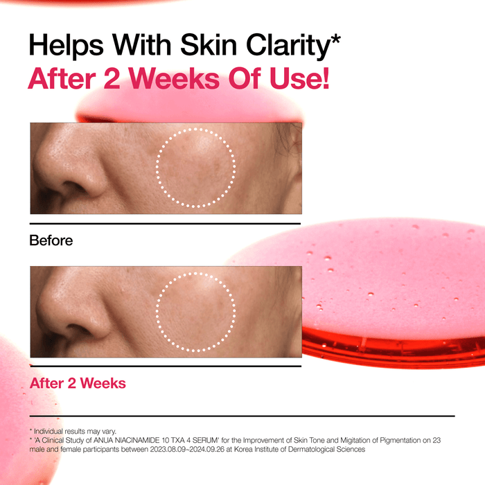 Anua Niacinamide 10% + TXA 4% Serum 30ml